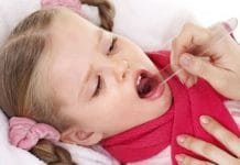 Šarlah kod djece – uzroci, simptomi i liječenje Šarlah kod djece - uzroci, simptomi i liječenje