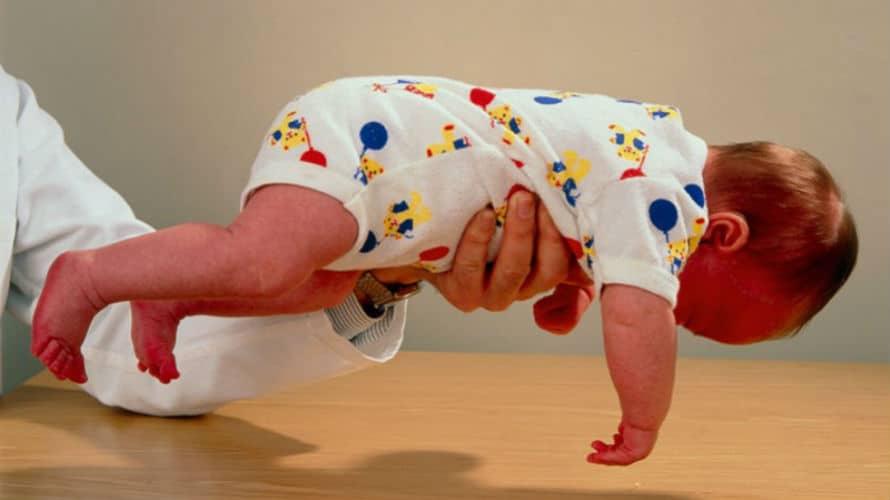 Hipotonija – uzroci, simptomi i liječenje Hipotonija – uzroci, simptomi i liječenje