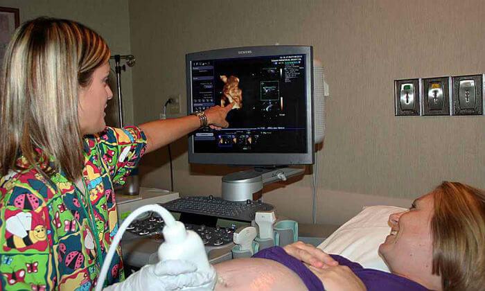4D ultrazvuk