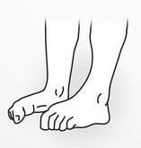 Bol u stopalu i gležnju - Vježba 5.