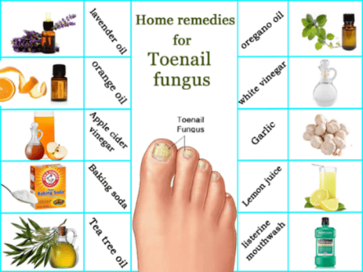 Prirodni "lijekovi" za gljivice na noktima